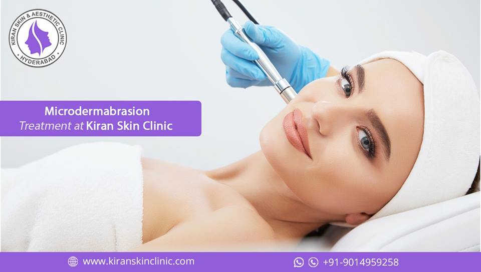 Microdermabrasion Treatment Kiran Skin Clinic Hyderabad
