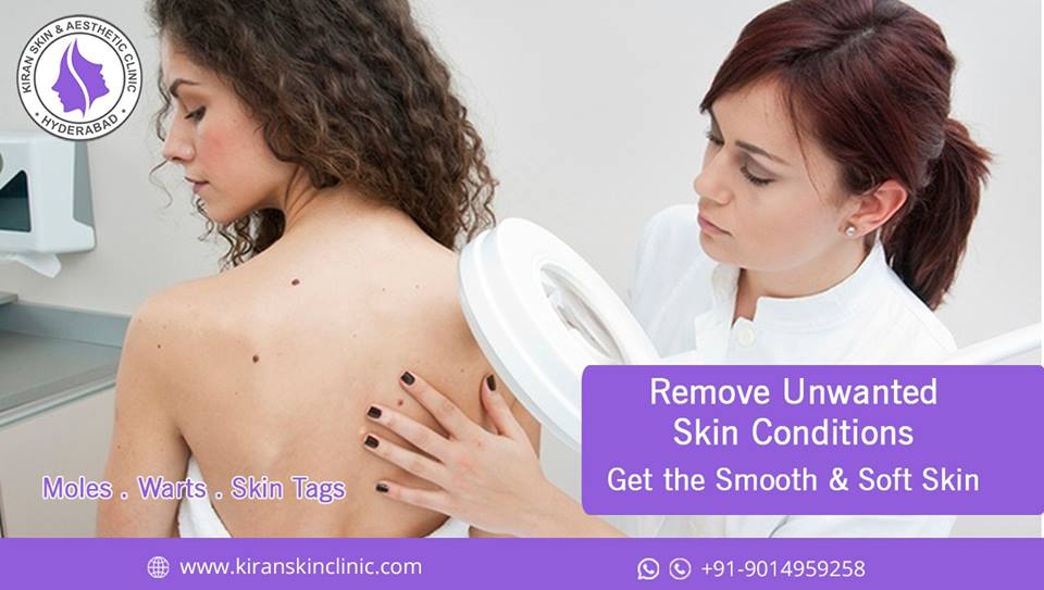 Remove_Unwanted_Skin_Conditions