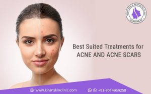 Best SkinClinic in Hyderabad