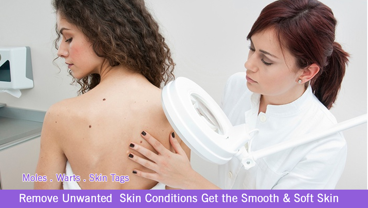 Skin Treatment in Hyderabad