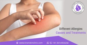 skin treatment in Hyderabad