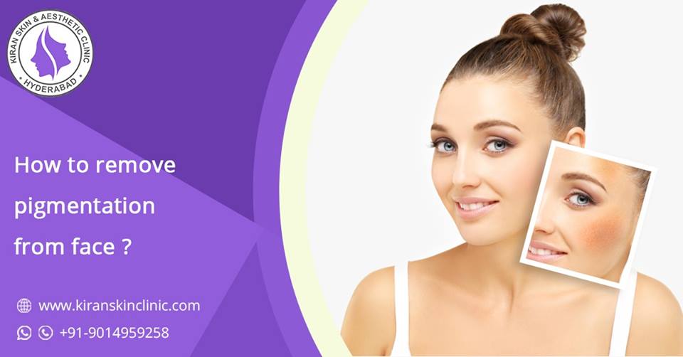 Skin Pigmentation Treatment in Hyderabad