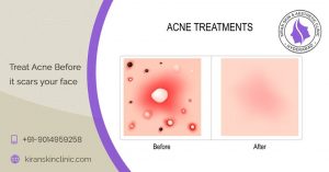 Best SkinClinic in Hyderabad