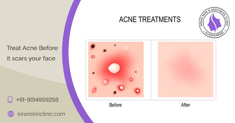 Best SkinClinic in Hyderabad