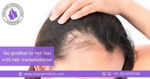 Hair Loss Treatment in Hyderabad