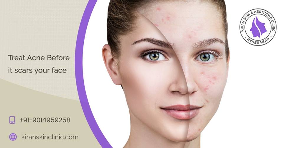 Best Skinclinic in Hyderabad