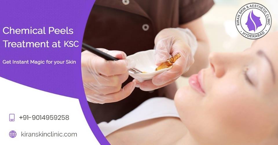 ChemicalPeels Treatment in Hyderabad