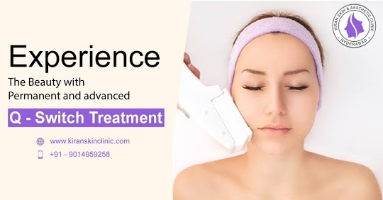 Q switch treatment in hyderabad