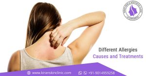 Skin treatment in Hyderabad