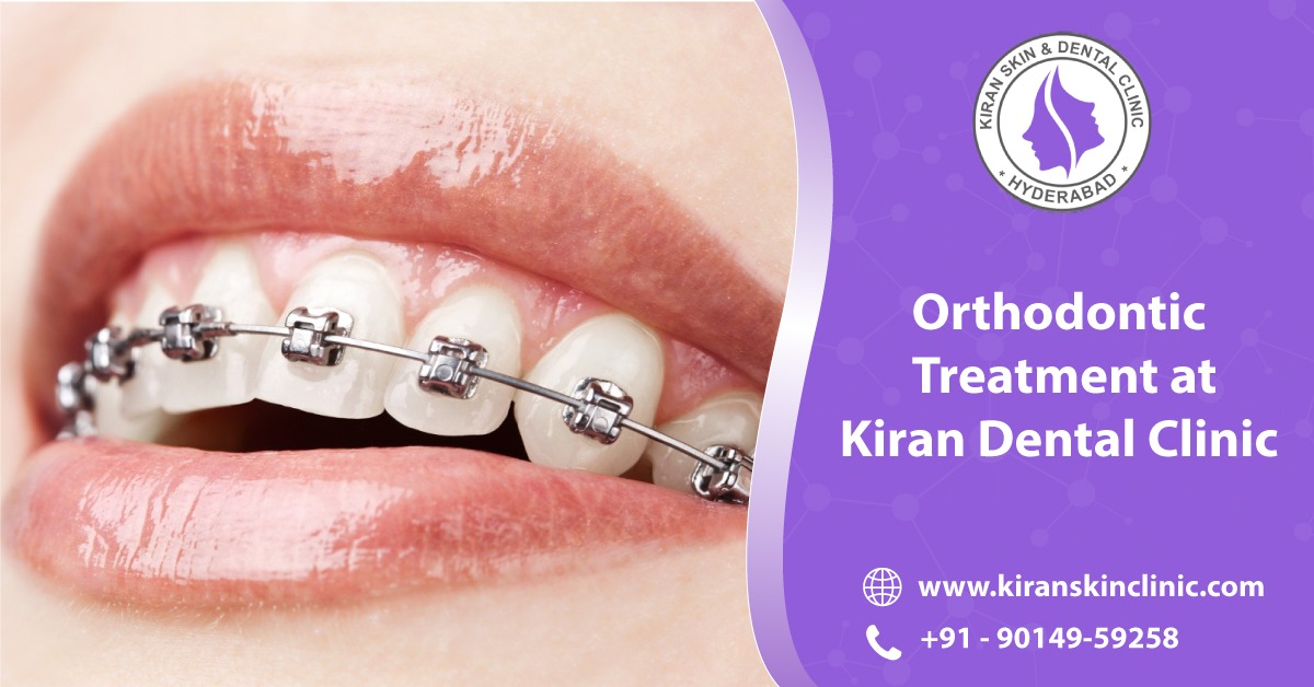 Orthodontic_Treatment_in_Hyderabad