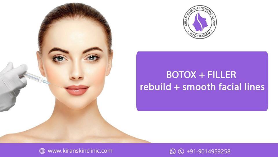 Botox_Filler_Treatment_in_Hyderabad