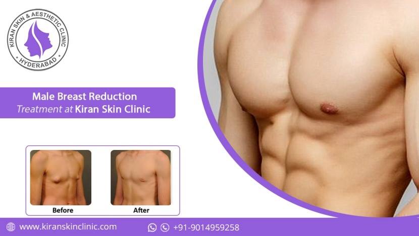 Male_Breasts_Reduction_Treatment_in_Hyderabad