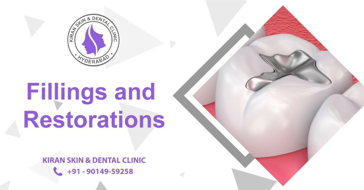 Fillings_and_Restorations_Treatment_in_Hyderabad