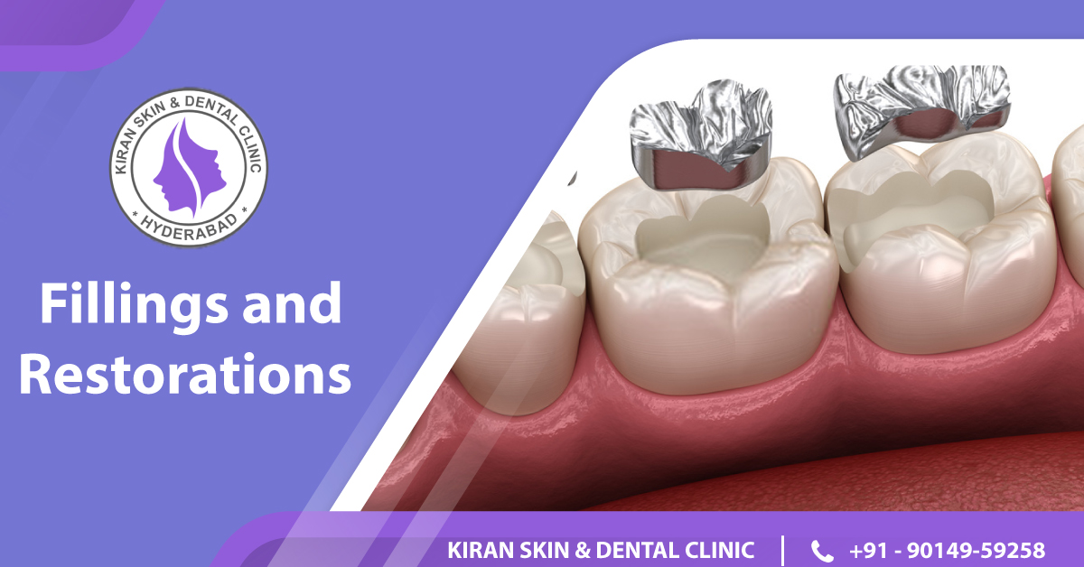 FILLINGS-AND-RESTORATIONS