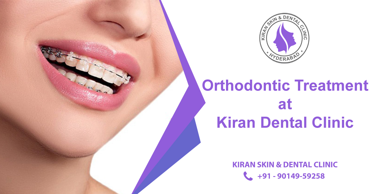 Orthodontic_Treatment_in_Hyderabad