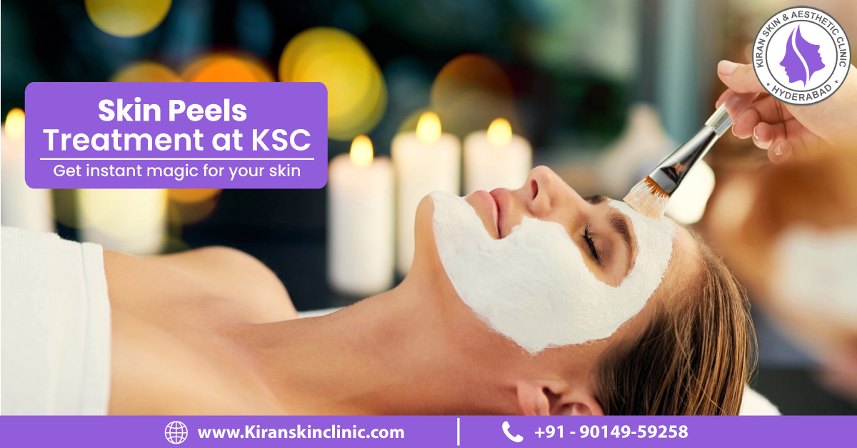 Skin_Peel_Treatment_in_Hyderabad