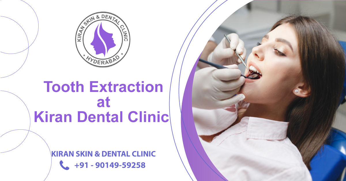 Tooth_Extraction_Treatment
