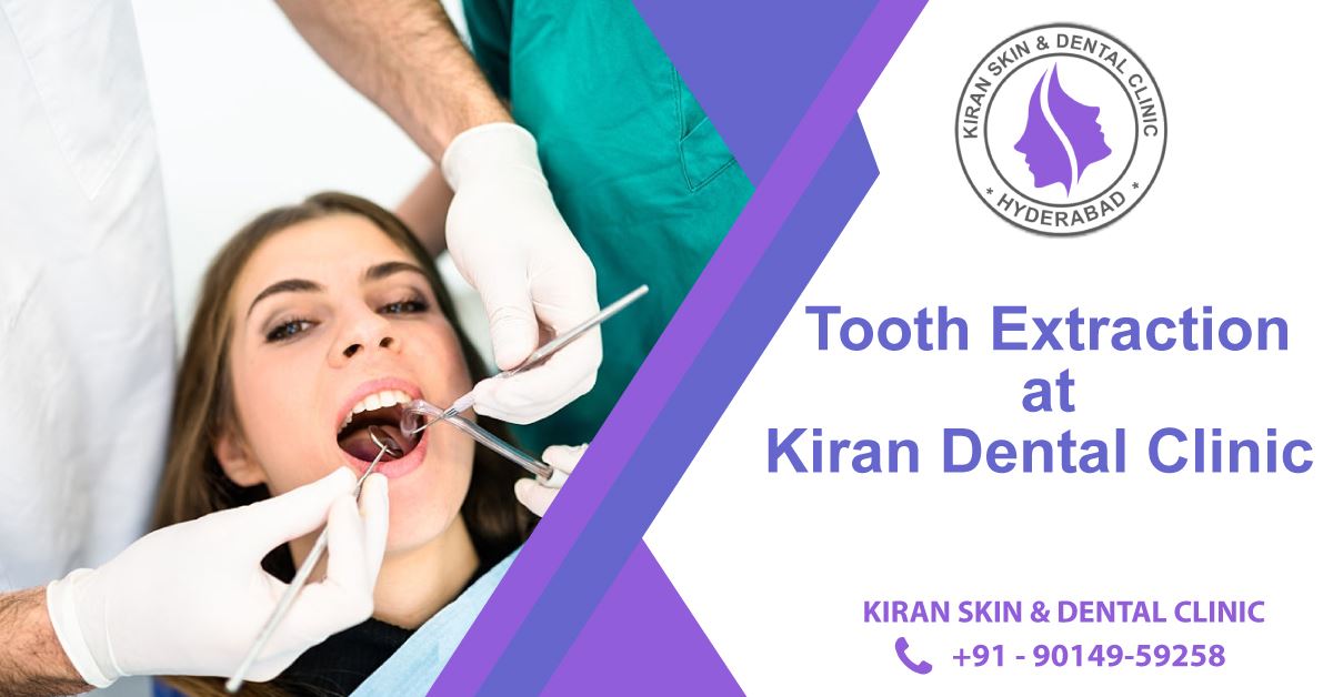 Tooth extraction treatment