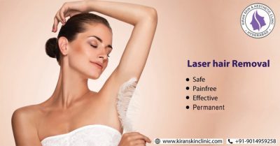 Laser Hair Removal Treatment