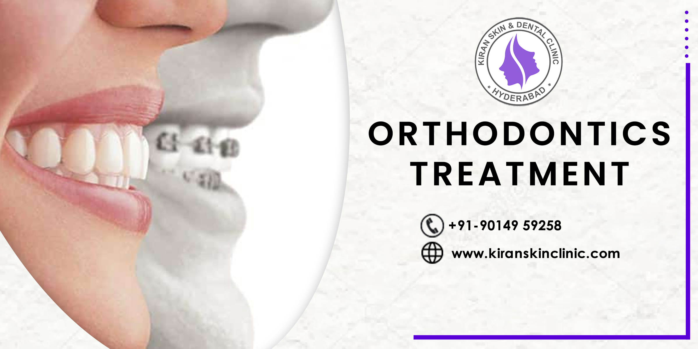 Orthodontic Treatment Involves