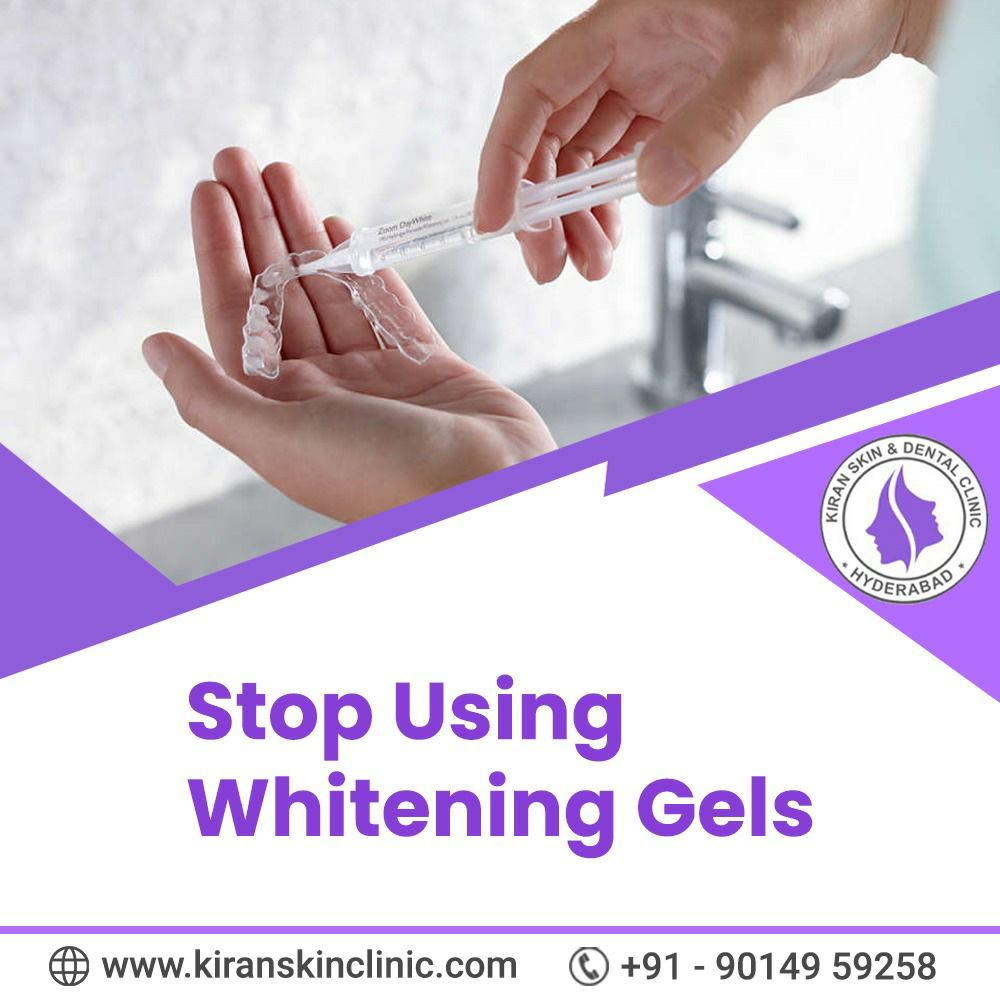 Stop Using Whitening Gels kiranskinclinic