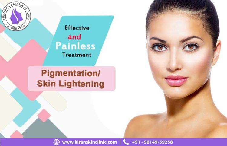 Effective and painless treatment for pigmentation