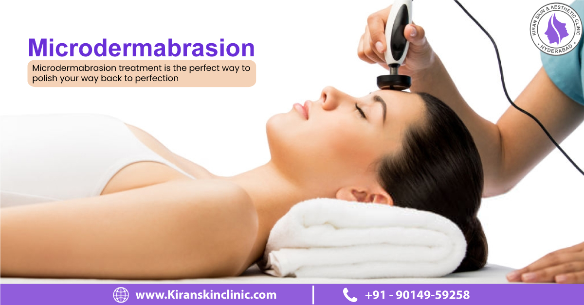 microdermabrasion treatment